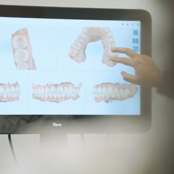 44a0a4977dd9b719cb7b80f7b138c0c731c61147